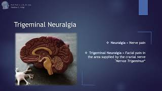 Briefly explained Trigeminal Neuralgia [upl. by Esertak]