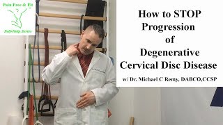 How to Stop Progression of Cervical Degenerative Disc Disease Home Self Rehab Tutorial [upl. by Raquela]