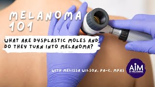 What are Dysplastic Moles and Do They Turn into Melanoma [upl. by Rayburn]