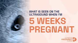 What would an ultrasound show at 5 weeks of pregnancy A London Pregnancy Clinic case study [upl. by Bartolemo]