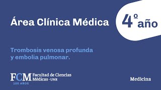 Área Clínica Médica  4 año Trombosis venosa profunda y embolia pulmonar [upl. by Ierbua]