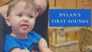 Dylans First Sounds  A Cochlear Implant Journey [upl. by Htor]