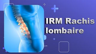 IRM du Rachis lombaire Bonne Pratique [upl. by Burne]