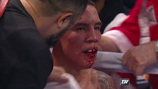 quotI COULDNT EAT OR DRINK FOR AWHILEquot  Oscar Valdez Recounts The Time He Broke His Jaw Against Quiqq [upl. by Veradis]