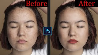 Fastest way to clean your face in photoshop  pimples blemishes acne  Adobe Photoshop Tutorial [upl. by Sirrad]