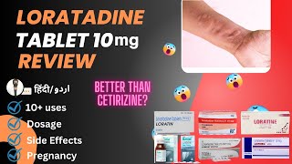 Loratadine  Loratadine 10mg Tablets Used For  Loratadine Tablets 10 mg hindi  Medical Creator [upl. by Nueovas]