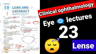 🔴 lense eye lectures 23  clinical Ophthalmology cataract surgery eye cataract [upl. by Nabatse]