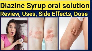 Diazinc syrup uses in Urdu  Zinc Sulphate syrup benefits Diazinc oral solution Uses Side Effects [upl. by Isdnil]