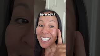 It’s starting to work Botox AntiWrinkle Wrinkles AntiAging SkinCare injectables housewife [upl. by Caye325]