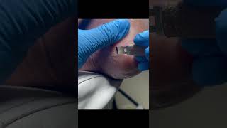 Charming Pedicure Video  Remove Dead Skin [upl. by Eerolam416]