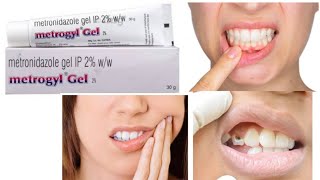 Metrogyl DG Gel Forte Use to teeth bacterial infection [upl. by Constant]