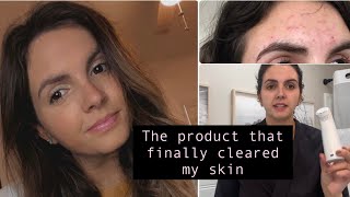 My Night Time Skincare Routine  The Life Changing Product That Cleared My Skin [upl. by Ecyrb]