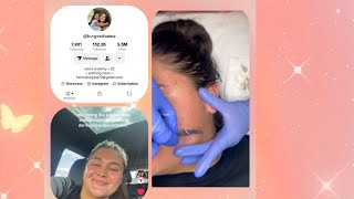 Hanna Burgess gets a Dermaplane ASMR ishhhh [upl. by Ecyla]