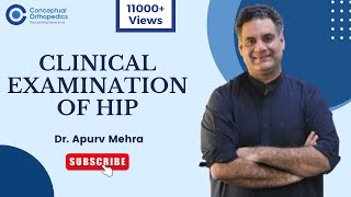 Clinical Examination of Hip By DrApurv Mehra ConceptualOrthopedics [upl. by Waylon]