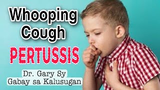 Whooping Cough Pertussis Causes Symptoms amp Treatment  Dr Gary Sy [upl. by Htiaf462]