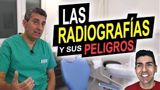 LAS RADIOGRAFÍAS Y SUS PELIGROS  ¿Producen cáncer ¿Debemos evitar las radiografías dentales [upl. by Garlinda157]