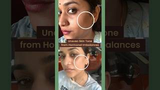 Indulekha Soap  For my uneven skin tone in just 4 weeks  Parvathy R Krishna [upl. by Strepphon596]