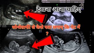 how to read sonographypregnancy ultrasound report kaise dekhe [upl. by Elana]