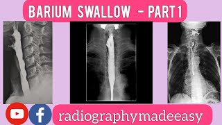 Barium Swallow  Part 1  Clinical Indications  GIT System  By Aaqib Bhat [upl. by Doreg]