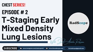 TStaging Early Mixed Density Lung Lesions [upl. by Willamina]