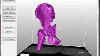 Extracting STL surface from CT data with DeVIDE [upl. by Ferdy724]