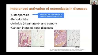 KRWebinar Intravital Imaging for monitoring osteoclast activity within hindlimb long bone [upl. by Baten]