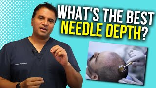 Dermarolling Optimal Needle Depth  The Hair Loss Show [upl. by Sharman]