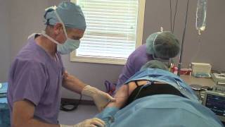 Laser Liposuction Surgery Louisville KY  Dr Garrett M Crabtree [upl. by Chipman]