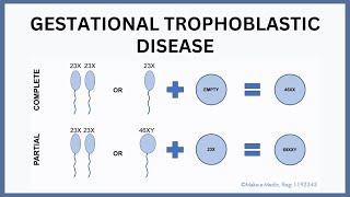 3 Gestational Trophoblastic Diseases and Molar Pregnancy 24112020 [upl. by Levitan]