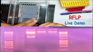 RFLP  Restriction Fragment Length Polymorphism LIVE DEMO [upl. by Eada132]