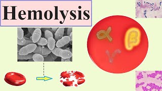 hemolysis [upl. by Nelav882]