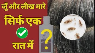 एक बार लगाओ लीख हटाओ  जू और लीख हटाने का अचूक फॉर्मूला how to use perlice cream on hair [upl. by Siuluj]