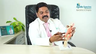 What is Ligament injury  Dr Illavarsan [upl. by Llenet]