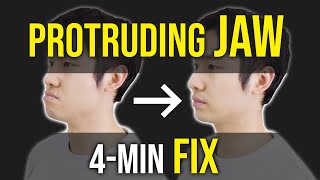 Protruding Jaw  Underbite Fix ｜Facial Asymmetry Correction｜Corrective Exercises [upl. by Pampuch]