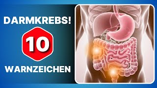 10 Symptome die zeigen dass Sie dringend eine Koloskopie machen müssen [upl. by Shenan]