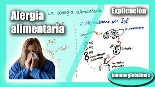 ¿Qué son las alergias a los alimentos Inmunoglobulina E hipersensibilidad [upl. by Jackquelin364]