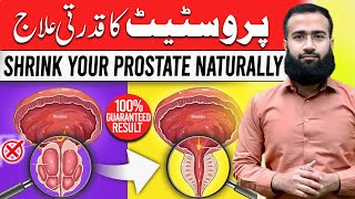 Shrink Prostate Naturally  Remedy for Healthy Prostate [upl. by Nibram377]