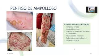 URGENCIAS EN DERMATOLOGIA I [upl. by Gierk]