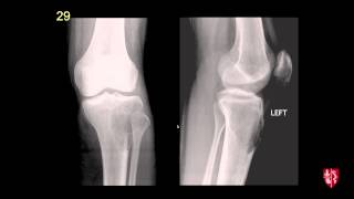 Radiology Boards Prep  MSK Cases [upl. by Capello]