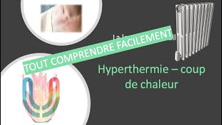 Urgences  la lecon avec cedille  hyperthermie coup de chaleur 🫨🥵 [upl. by Mathias]