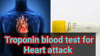 Troponin cTnI cTnT  or troponin I or Troponin T blood test cardiac markers [upl. by Akeimat]