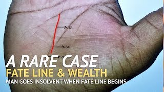 A Unique Case of Fate Line in Palmistry [upl. by Constanta346]