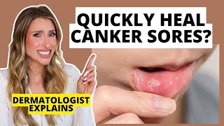 Quickly Heal Canker Sores How to Prevent amp Heal Them Faster  Dermatologist Explains [upl. by Dorcas]