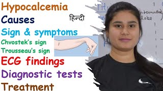 Hypocalcemia  Causes  Symptoms  ECG findings  Diagnostic Tests  Treatment [upl. by Clari]