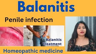 Balanitis penile infection treatment  Balanitis symptomscauses amp homeopathic medicine in hindi [upl. by Annaiel]