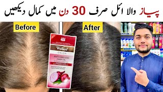 Wellice Anti Hair Loss Onion Hair Oil For Hair Growth amp Stope Hair Fall [upl. by Leahcimdivad]