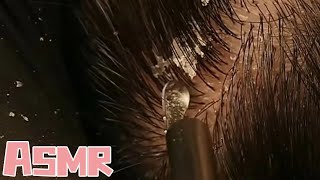 ASMR｜Immersive scalp care to help you sleep deep cleansing of dandruff so comfortable AidSleep [upl. by Ayouqes658]