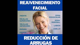 Rejuvenecimiento Facial con Radiofrecuencia Exilis 360 Ultra [upl. by Mercuri]