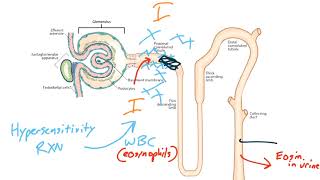 Acute Kidney Injury for the USMLE Step 1 [upl. by Franchot997]