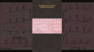 ECG Diagnosis [upl. by Sinegra]